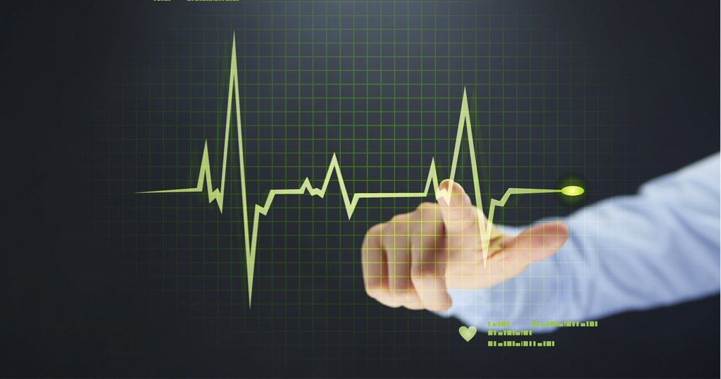 Which Heart Rate Monitor is Best For Your Clients?